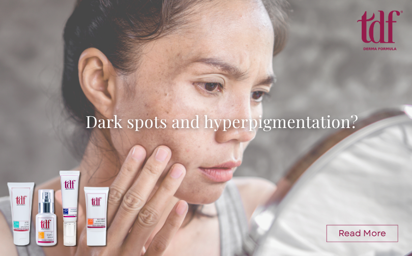 Dark Spots, Be Gone: Your Guide to Brighter, Even Skin